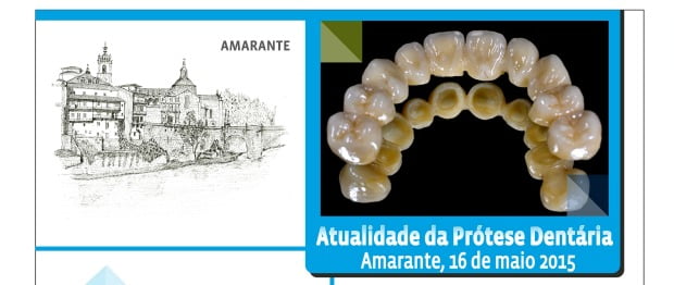 Facetas não partem? Mito ou Realidade? A resposta vai ser dada em Amarante