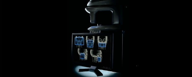 Carestream Dental Portugal lança CS 9300