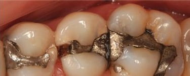 Malo Clinic organiza Curso Modular de Dentisteria