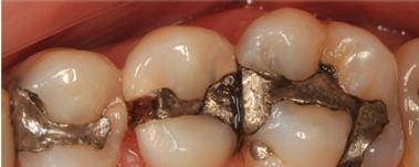Malo Clinic organiza Curso Modular de Dentisteria