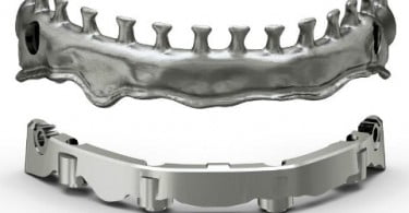 Dentsply Implants com novas soluções