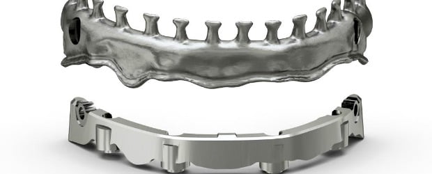 Dentsply Implants com novas soluções