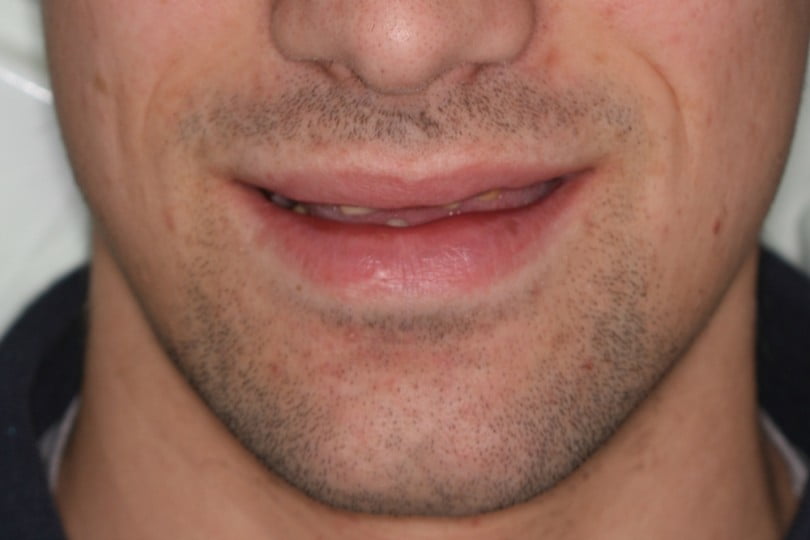 FIG Fotografia extra oral pre operatoria