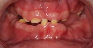 FIG Fotografia intra oral pre operatoria