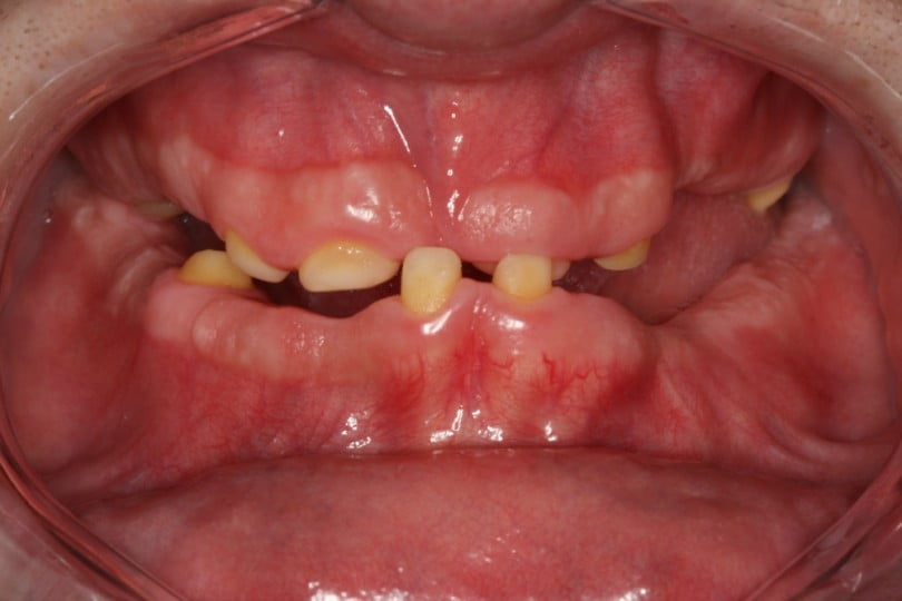 FIG Fotografia intra oral pre operatoria