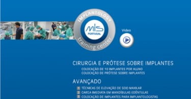 Implantology Training Center promove Curso de Cirurgia e Prótese sobre Implantes