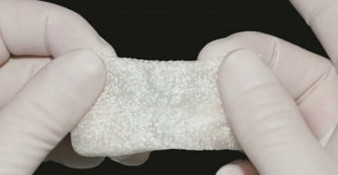 Matri Bone