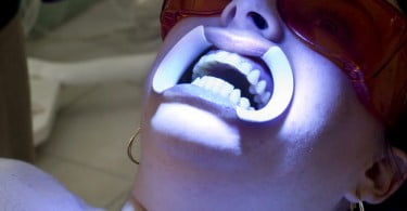 Glavis promove curso de dor oro-facial
