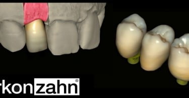Zirkonzahn com CAD/CAM Reality Mode