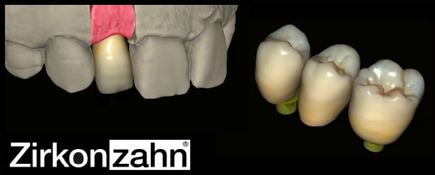 Zirkonzahn com CAD/CAM Reality Mode