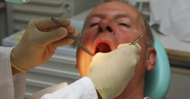 Estudo revela que Zirconia Prettau quase não provoca abrasão