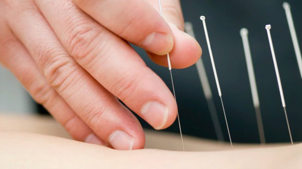 Acupuntura pode reduzir reflexos de vómito em pacientes dentários