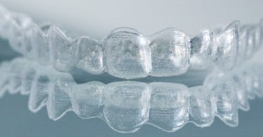 Ortoplus lança produto de Ortodontia Invisível