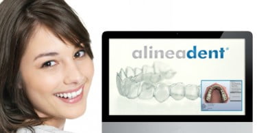 Cursos de tratamento alineadent com prazos alargados