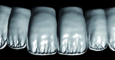 Zirkonzahn lança biblioteca dentária virtual