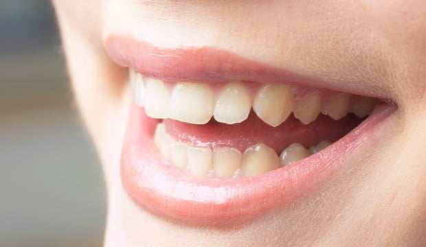 OMD e DGS comemoram Dia Mundial da Saúde Oral com programa especial