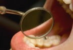 Sensores embutidos nos dentes revelam hábitos de higiene