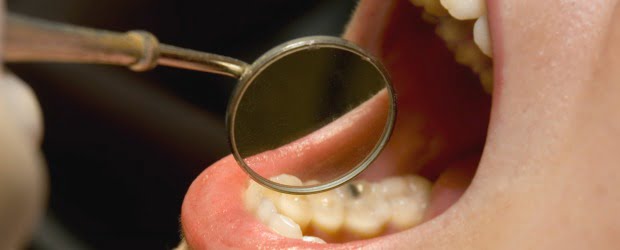 Sensores embutidos nos dentes revelam hábitos de higiene