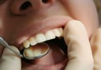 boca examinacao Saude Oral