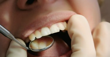 boca examinacao Saude Oral