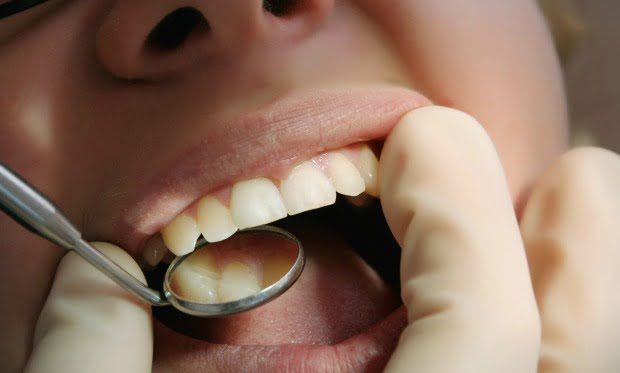 boca examinacao Saude Oral