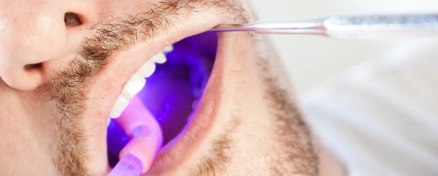 Dentistas exigem que branqueadores sejam vendidos só com receita