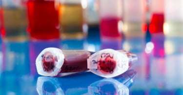 Cientistas descrevem mecanismo que leva células estaminais a reparar lesões dentárias