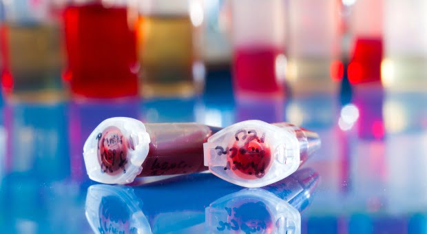 Cientistas descrevem mecanismo que leva células estaminais a reparar lesões dentárias