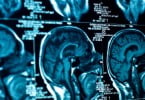 Cientistas conseguem medir dor a partir de imagens do cérebro