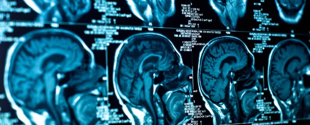 Cientistas conseguem medir dor a partir de imagens do cérebro