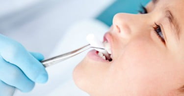 Número de crianças sem cáries dentárias atinge recorde na Escócia