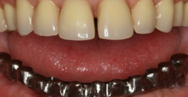 Curso de Fotografia e Photoshop Aplicado à Medicina Dentária