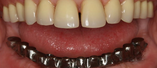 Curso de Fotografia e Photoshop Aplicado à Medicina Dentária