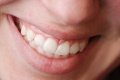 Curso de Fotografia Dentária