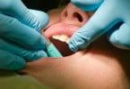 cáries dentárias pessoa a fazer check up