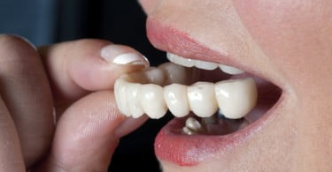 Novo dente artificial pode substituir dentaduras