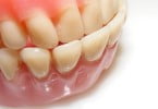 Philips apresenta solução para biofilme na IDS