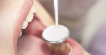 Governo vai criar programa de rastreio para cancro oral