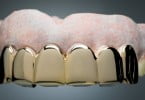 Utilização de ouro em aplicações dentárias em declínio