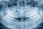 Fundação Grünenthal entrega bolsa de 10 mil euros a investigação sobre disfunção temporomandibular