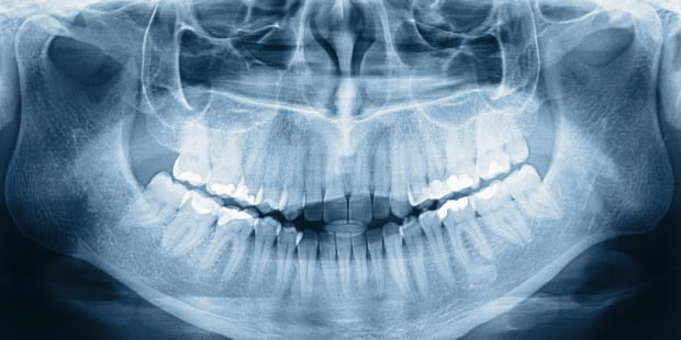 Fundação Grünenthal entrega bolsa de 10 mil euros a investigação sobre disfunção temporomandibular