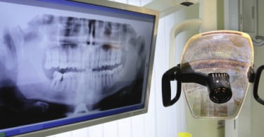 Seminário FDI/OMD: Cancro Oral e Saúde Oral em Portugal
