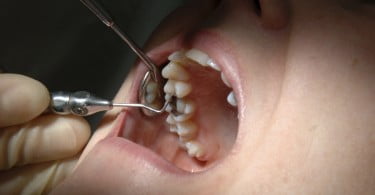 Sorriso Natural anuncia 10 cursos de Medicina Dentária
