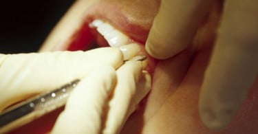 OMD organiza estudo sobre medicina dentária portuguesa