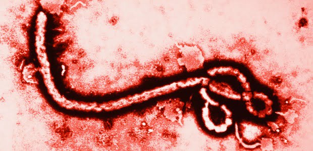 Ébola: CDC e DGS divulgam diretrizes para médicos dentistas