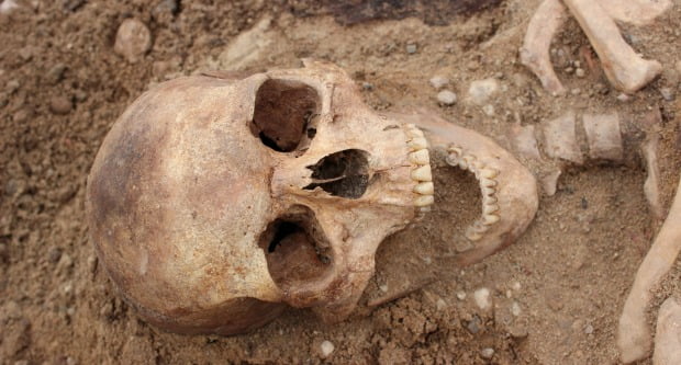 Análise à dentição do rei Ricardo III revela pormenores sobre estilo de vida