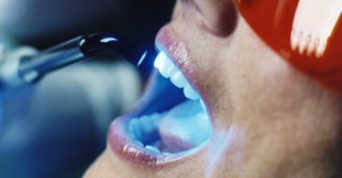 Fadente com tecnologia para imagens faciais a 3D