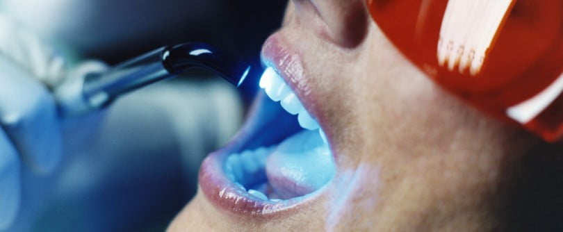 Fadente com tecnologia para imagens faciais a 3D