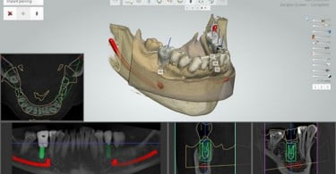 BioHorizons Ibérica é agora a distribuidora oficial da 3Shape em Portugal