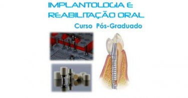 Curso Pós-Graduado em Implantologia e Reabilitação Oral
